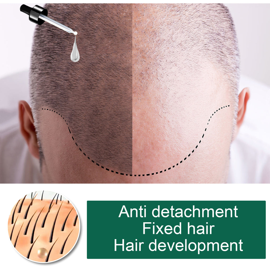 Aceite capilar de jengibre EELHOE, hidratante, suavizante, reparador, para cabello encrespado y dañado. Aceite esencial.